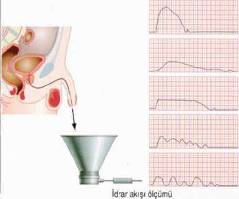 uroflowmetri testi